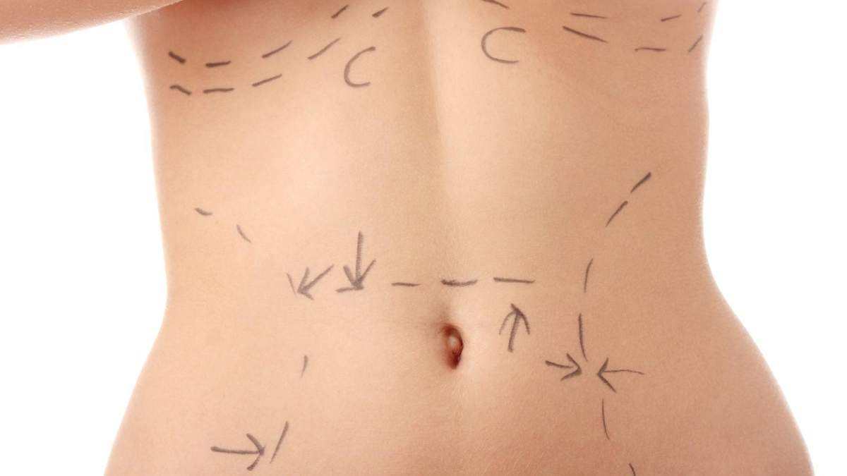 Как избавиться от жировых ловушек: эффективный метод показали на видео Как избавиться от жировых ловушек: эффективный метод показали на видео